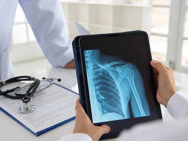 Digital X-Ray